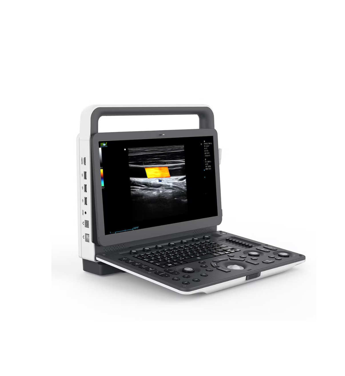 MSLCU77 portable 4D color Doppler ultrasound + convex probe