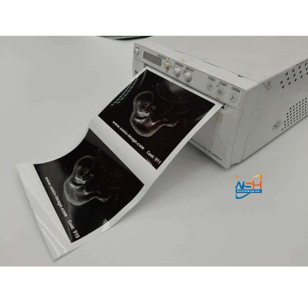 SONIX IMAGE UPP-110HD