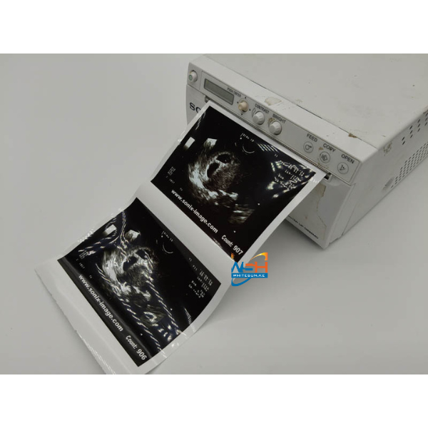 Ultrasound Paper Rolls UPP-110HD