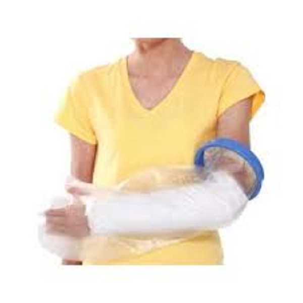 Adult Full Arm Cast